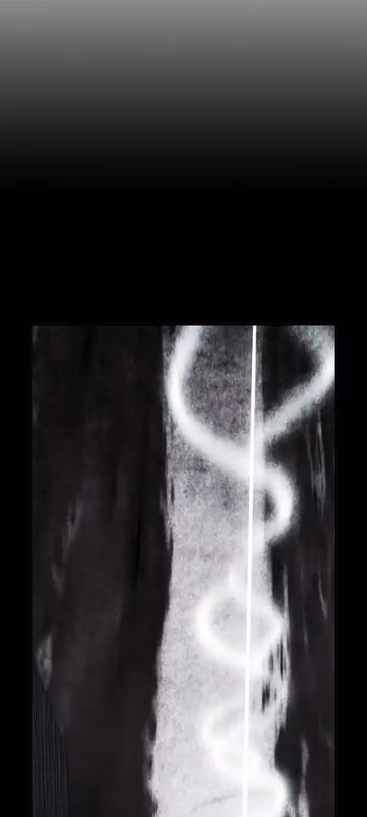 Página do Capítulo 171